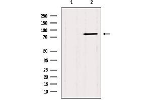Western blot analysis of extracts from Mouse brain, using CTNNAL1 Antibody. (CTNNAL1 anticorps  (Internal Region))
