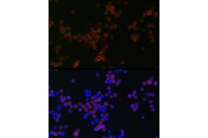 Immunofluorescence analysis of R.