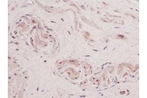 Image no. 1 for anti-Thymic Stromal Lymphopoietin (TSLP) antibody (ABIN465621) (Thymic Stromal Lymphopoietin anticorps)