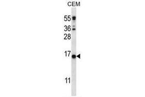 CJ057 Antibody (C-term) western blot analysis in CEM cell line lysates (35µg/lane). (CJ057 anticorps  (C-Term))