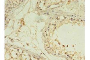 IHC analysis of paraffin-embedded human testis tissue, using G0S2 antibody (1/100 dilution). (G0S2 anticorps  (AA 1-103))