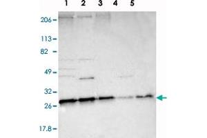 Western blot analysis of Lane 1: RT-4, Lane 2: U-251 MG, Lane 3: A-431, Lane 4: Liver, Lane 5: Tonsil with STX8 polyclonal antibody .