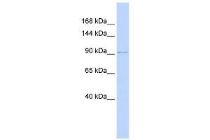 NDST3 antibody used at 1 ug/ml to detect target protein. (NDST3 anticorps)