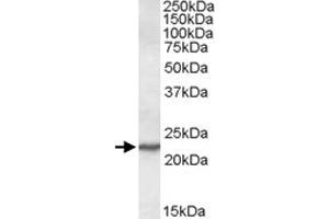 SAR1A polyclonal antibody  (0. (SAR1A anticorps)
