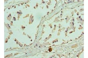 Immunohistochemistry of paraffin-embedded human prostate tissue using ABIN7155474 at dilution of 1:100