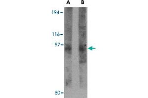 Western blot analysis of TMC8 in rat thymus tissue lysate with TMC8 polyclonal antibody  at (A) 1 and (B) 2 ug/mL . (TMC8 anticorps  (N-Term))
