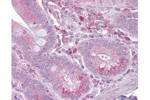 Anti-SLC13A2 antibody IHC of human small intestine.