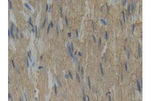 Used in DAB staining on fromalin fixed paraffin- embedded rectum tissue (Plastin 3 anticorps  (AA 234-475))