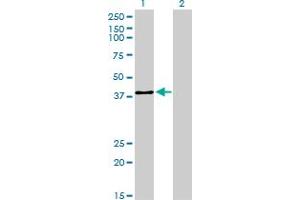 Western Blot analysis of USF2 expression in transfected 293T cell line by USF2 monoclonal antibody (M01), clone 5E9. (USF2 anticorps  (AA 1-100))