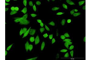 Immunofluorescence of purified MaxPab antibody to PSMD10 on HeLa cell. (PSMD10 anticorps  (AA 1-226))