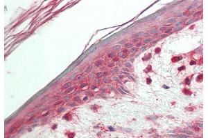 Rabbit Anti-VPS52 antibody Catalog Number: ARP57644 Formalin Fixed Paraffin Embedded Tissue: Human Skin Primary antibody Concentration: 1:100 Secondary Antibody: Donkey anti-Rabbit-Cy3 Secondary Antibody Concentration: 1:200 Magnification: 20x Exposure Time: 0.