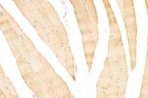 Immunohistochemistry analysis of paraffin-embedded rat skeletal muscle using,alpha Actinin (ABIN7073023) at dilution of 1: 500 (alpha Actinin anticorps)