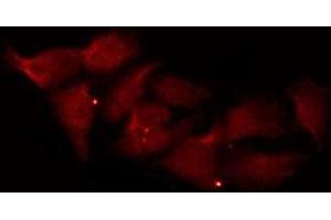 ABIN6269380 staining HepG2 by IF/ICC.