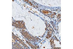 IHC analysis of SFXN3 using anti-SFXN3 antibody (ABIN7601302). (SFXN3 anticorps  (AA 32-321))