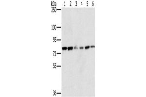 Western Blotting (WB) image for anti-NADPH Oxidase 5 (NOX5) antibody (ABIN2430559) (NOX5 anticorps)