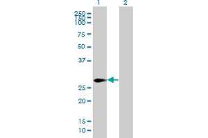 Western Blot analysis of SPANXN2 expression in transfected 293T cell line by SPANXN2 MaxPab polyclonal antibody.
