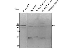 Anti-VEGFR2 antibody at 1/500 dlution, rabbit palyclonal to goat lgG (HRP), at 1/10,000 dilution, (VEGFR2/CD309 anticorps  (AA 20-125))