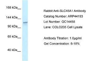 WB Suggested Anti-SLC45A1 Antibody   Titration: 1. (SLC45A1 anticorps  (N-Term))