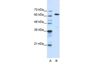 WB Suggested Anti-NXF1 Antibody Titration:  1. (NXF1 anticorps  (N-Term))
