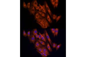Immunofluorescence analysis of C2C12 cells using CLIC1 Rabbit pAb (ABIN6128983, ABIN6138719, ABIN6138721 and ABIN6217770) at dilution of 1:150 (40x lens). (CLIC1 anticorps  (AA 42-241))
