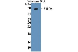 Detection of Recombinant gp130, Rat using Polyclonal Antibody to Glycoprotein 130 (gp130) (CD130/gp130 anticorps  (AA 26-323))