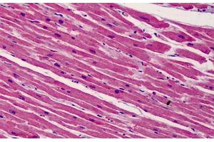 Human Heart: Formalin-Fixed, Paraffin-Embedded (FFPE) (BID anticorps  (C-Term))