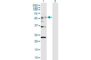 Western Blot analysis of CHRNA4 expression in transfected 293T cell line by CHRNA4 MaxPab polyclonal antibody. (CHRNA4 anticorps  (AA 1-451))