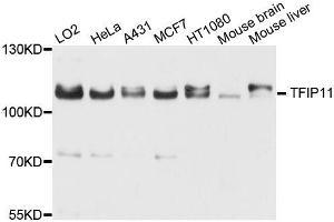 Western blot analysis of extracts of various cell lines, using TFIP11 antibody (ABIN5996279) at 1/1000 dilution. (TFIP11 anticorps)