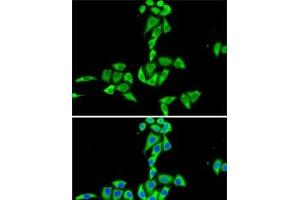 Immunofluorescence analysis of HeLa cells using CES2 Polyclonal Antibody (CES2 anticorps)