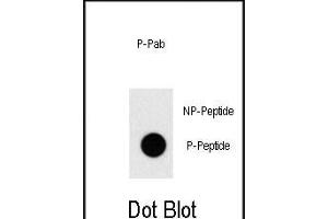 Dot blot analysis of anti-Phospho-TAL1-pT90 Pab (ABIN650830 and ABIN2839799) on nitrocellulose membrane. (TAL1 anticorps  (pThr90))