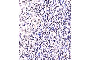 (ABIN6243067 and ABIN6578362) staining BCL6 in Human tonsil tissue sections by Immunohistochemistry (IHC-P - paraformaldehyde-fixed, paraffin-embedded sections).