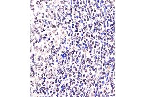 (ABIN6243067 and ABIN6578362) staining BCL6 in Human tonsil tissue sections by Immunohistochemistry (IHC-P - paraformaldehyde-fixed, paraffin-embedded sections). (BCL6 anticorps  (AA 364-395))