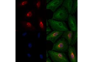 ABIN6260520 and ABIN6276510 staining  cells by IF/ICC. (CBX5 anticorps  (Internal Region))