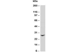 Western blot testing of GJB2 antibody and rat liver tissue lysate (GJB2 anticorps  (N-Term))