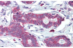 Rabbit Anti-HOXA5 Antibody Catalog Number: ARP39383 Paraffin Embedded Tissue: Human Breast Antibody Concentration: 5 ug/ml