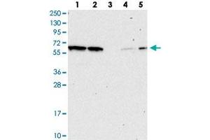 Western blot analysis of Lane 1: RT-4, Lane 2: U-251 MG, Lane 3: Human Plasma, Lane 4: Liver, Lane 5: Tonsil with NAE1 polyclonal antibody . (NAE1 anticorps)