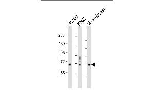 All lanes : Anti-TCF4 Antibody (N-term) at 1:1000 dilution Lane 1: HepG2 whole cell lysate Lane 2: K562 whole cell lysate Lane 3: Mouse cerebellum whole tissue lysate Lysates/proteins at 20 μg per lane. (TCF4 anticorps  (N-Term))