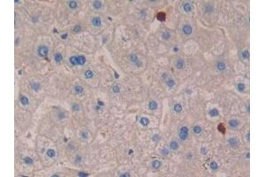 Detection of IL16 in Human Liver Tissue using Polyclonal Antibody to Interleukin 16 (IL16)