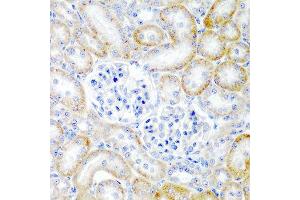 Immunohistochemistry of paraffin-embedded rat kidney using RLN2 antibody at dilution of 1:200 (40x lens). (Relaxin 2 anticorps)