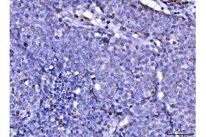 IHC analysis of RAE1 using anti-RAE1 antibody (ABIN7602428). (RAE1 anticorps  (AA 76-368))