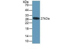 Detection of Recombinant MYL4, Human using Polyclonal Antibody to Myosin Light Chain 4, Alkali, Atrial, Embryonic (MYL4) (MYL4 anticorps  (AA 6-191))
