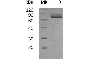 Western Blotting (WB) image for 5'-Nucleotidase, Ecto (CD73) (NT5E) protein (His tag) (ABIN7321272) (CD73 Protein (His tag))