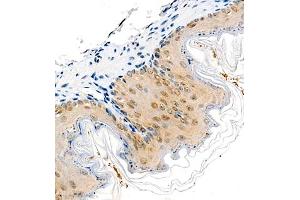 Immunohistochemistry of paraffin embedded mouse stomach using COPS2 (ABIN7073324) at dilution of 1:1400 (400x lens) (CSN2 anticorps)