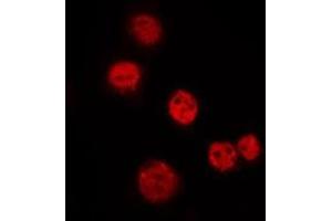 ABIN6275288 staining Hela by IF/ICC. (N4BP1 anticorps  (Internal Region))