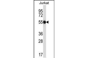 Western blot analysis in Jurkat cell line lysates (35ug/lane). (CNOT2 anticorps  (AA 272-301))