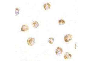 Immunocytochemistry of Sumo in HL60 cells with this product at 5 μg/ml.