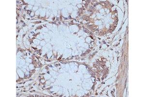 Immunohistochemistry of paraffin-embedded Human colon using SNW1 Polyclonal Antibody at dilution of 1:100 (40x lens).