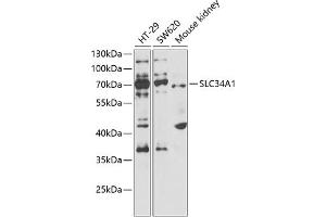 Western blot analysis of extracts of various cell lines, using SLC34 antibody  at 1:1000 dilution. (Solute Carrier Family 34 (Type II Sodium/phosphate Contransporter), Member 1 (SLC34A1) anticorps)