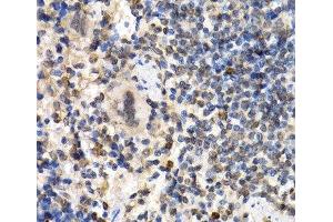 Immunohistochemistry of paraffin-embedded Mouse spleen using RAD1 Polyclonal Antibody at dilution of 1:200 (40x lens).