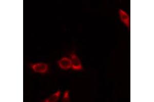 ABIN6274392 staining Hela by IF/ICC. (FASTKD1 anticorps  (Internal Region))
